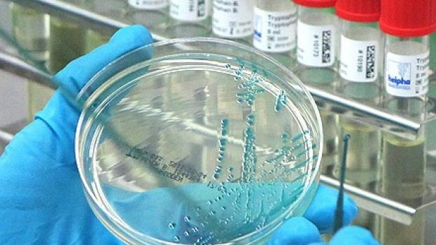 WHO reports first human death from new bird flu strain 