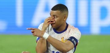 Mbappe suffers broken nose during France win 