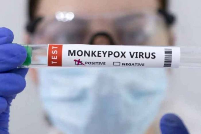 Azerbaijan reports zero cases of mpox