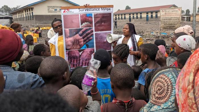 IOM launches $18.5M appeal to aid mpox patients in Africa 