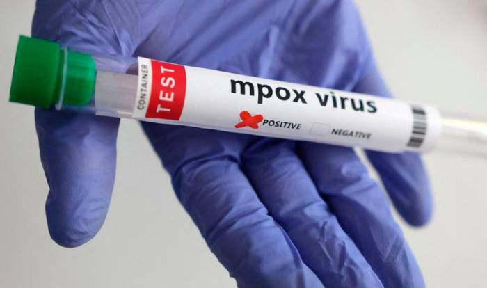 UNICEF seeks $16.5M to tackle mpox outbreak in Africa 