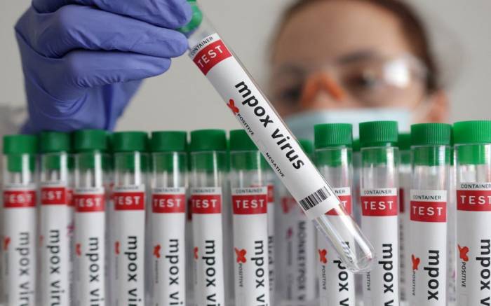 Philippines records two new mpox cases