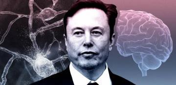 Elon Musk aims to implant Neuralink brain chips into millions of people