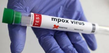 Gabon confirms first mpox case