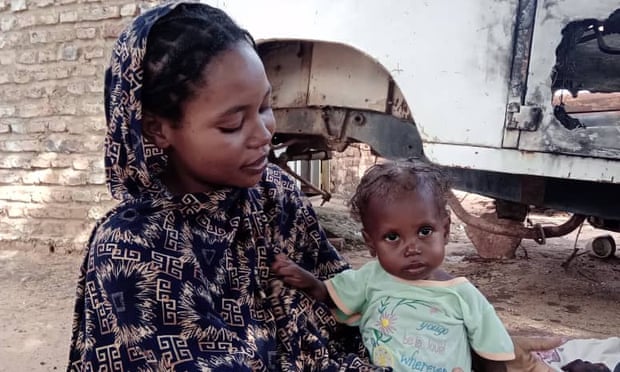 News about - Daily at least 10 children die of hunger in this war-torn city