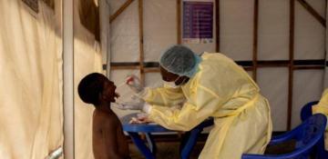 Youngsters among most affected by mpox outbreak in Africa: UNICEF 
