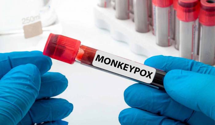 WHO approves first mpox diagnostic test for emergency use