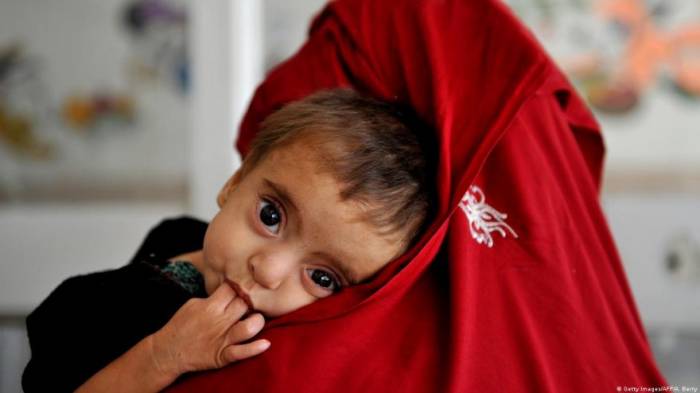 Japan donates $7 million to support vulnerable Afghans 