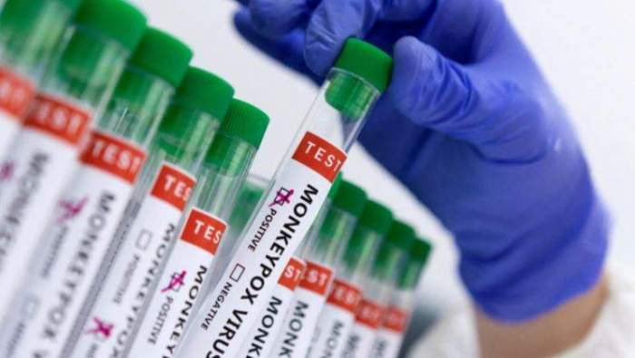 Uganda confirms first mpox death as infections rise to 164 