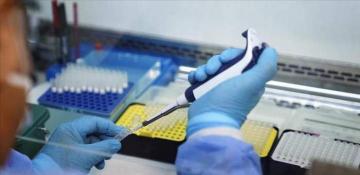 Kenya reports its first mpox death amid regional outbreak 