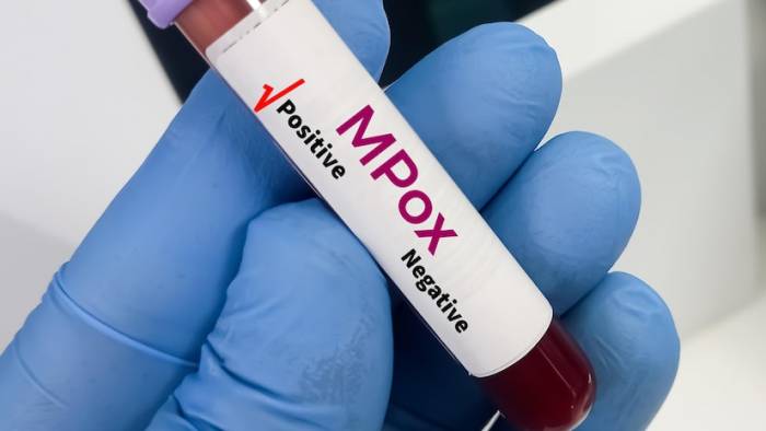 UK records two more cases of new mpox variant