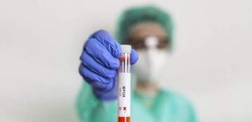 Africa CDC recommends first locally manufactured PCR test for mpox 