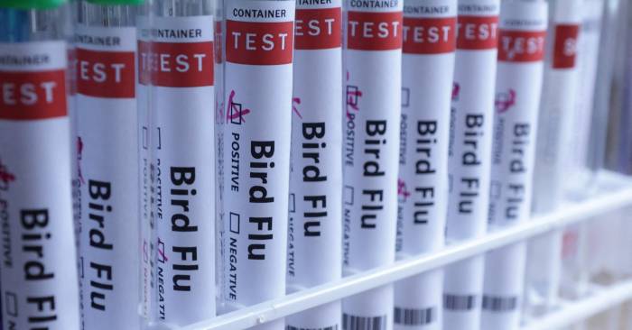 US detects first severe human case of bird flu