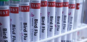 US detects first severe human case of bird flu