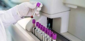 Hundreds of deadly virus samples disappear from Australian laboratory  -VIDEO 