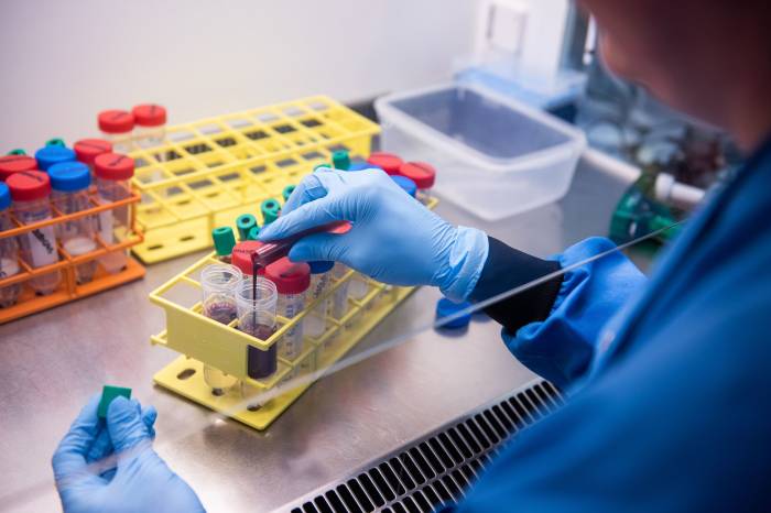 India detects three human metapneumovirus cases