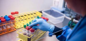 India detects three human metapneumovirus cases