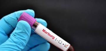 Tanzania refutes WHO report on suspected Marburg outbreak