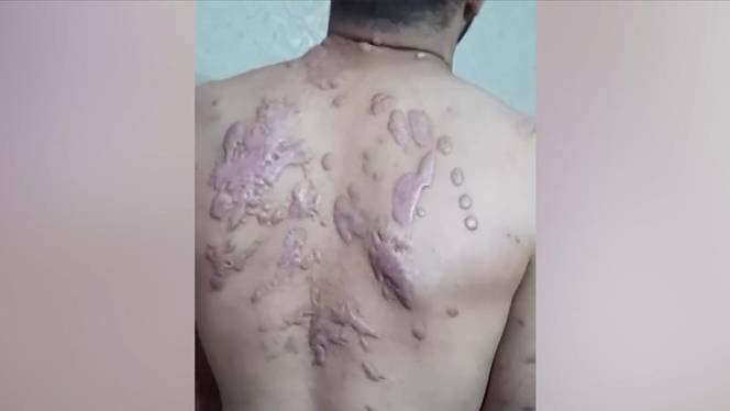 2025/02/gaza--3481158314.jpg + Israel's torture of Palestinian prisoners exposed as inhumane News about - Israel's torture of Palestinian prisoners exposed as inhumane