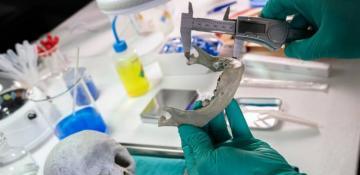 Australian AI tool capable of identifying sex of human skulls with 97 pct accuracy 