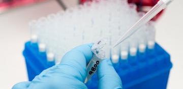 Australia records first death from Japanese encephalitis in almost three years