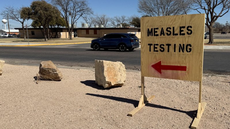 Two dead, 230 sick in US measles outbreak 