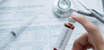 Tuberculosis cases rise among kids in Europe and Central Asia, warn authorities 