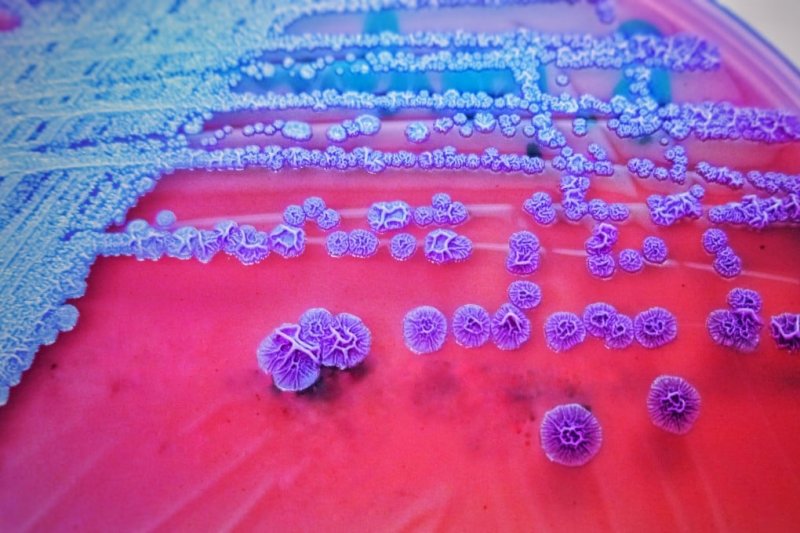 Melioidosis outbreak in northeast Australia claims 26 lives