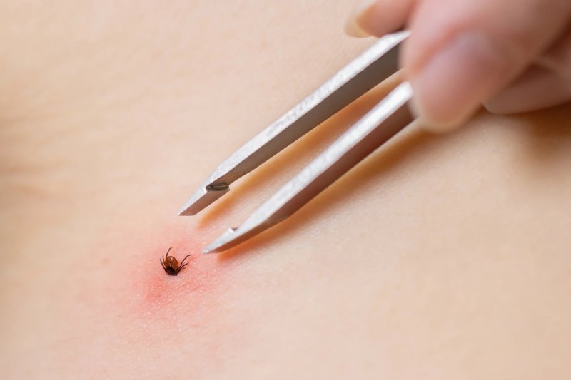 Mongolia detects 44 cases of tick-borne diseases in 2025