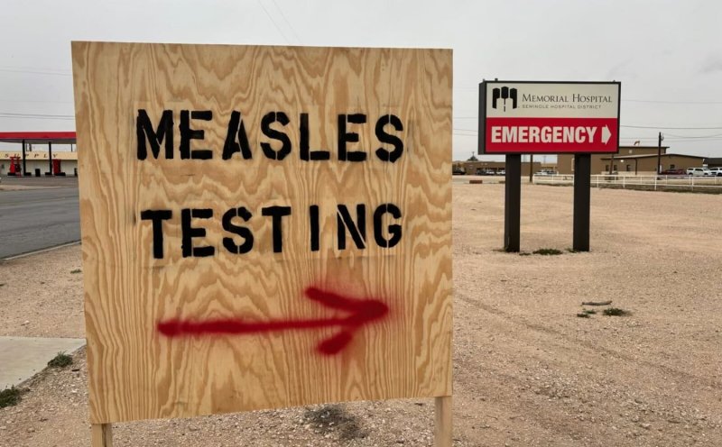 US faces largest measles outbreak in a decade