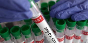 UK detects new Clade Ib mpox case