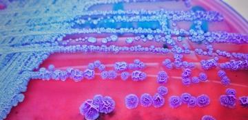 Melioidosis outbreak in northeast Australia claims 26 lives