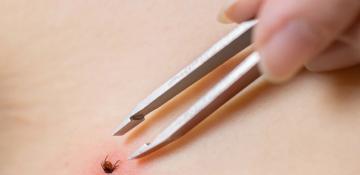 Mongolia detects 44 cases of tick-borne diseases in 2025