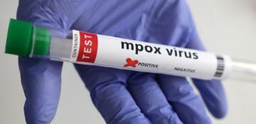 Philippines confirms one death from mpox