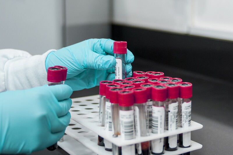 Philippines records first case of highly pathogenic avian flu strain