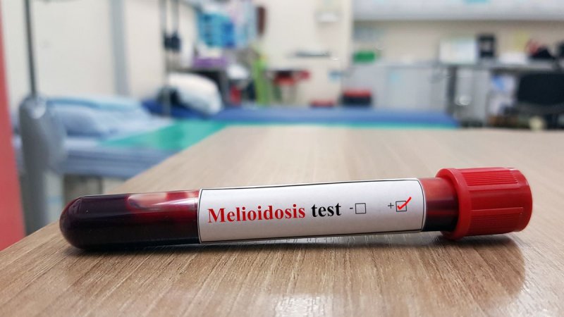 Australia reports surge in melioidosis cases; death toll hits 31