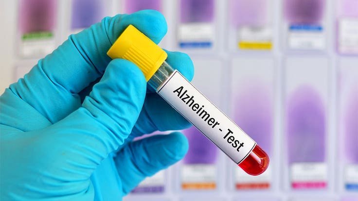US approves first blood test for Alzheimer's