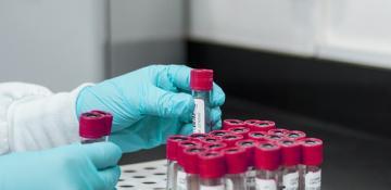 Philippines records first case of highly pathogenic avian flu strain