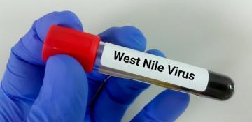 UK health authorities confirm West Nile virus in mosquitoes