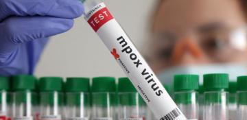 Malawi records 6th mpox case