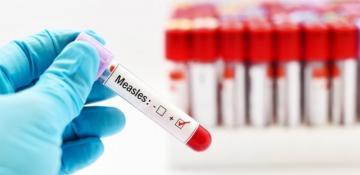 Measles infections reach 25-year high in Europe