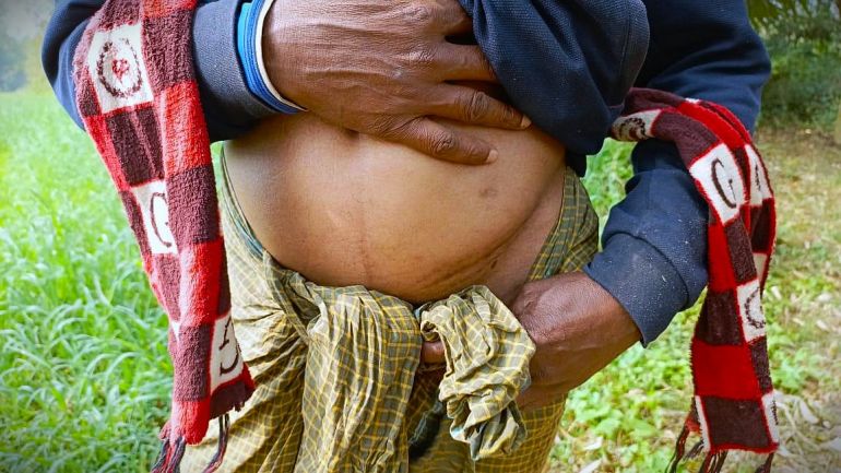 News about - ‘Village of One Kidney’: Cross-border organ trafficking exploits Bangladesh’s poor