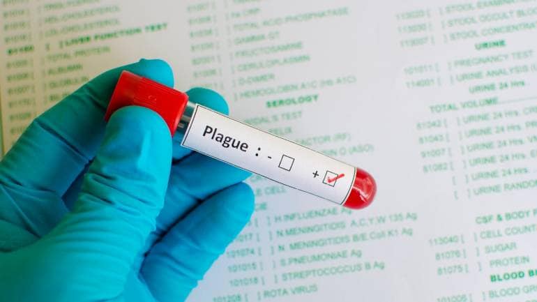 One dead after contracting plague in northern Arizona