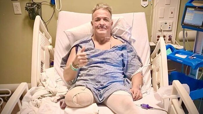 WWE legend Buff Bagwell undergoes above-knee leg amputation