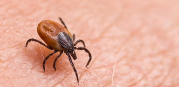 Experts warn of tick-borne disease surge in US