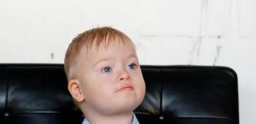 Scientists claim to remove chromosome linked to Down syndrome