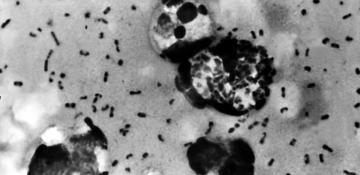 Arizona resident dies from plague, health officials say 
