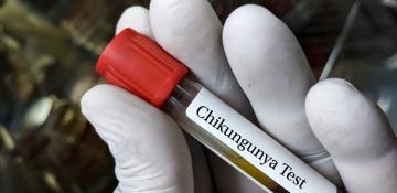 UK sees sharp rise in Chikungunya cases