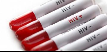 Azerbaijan reveals number of registered HIV cases for 2024