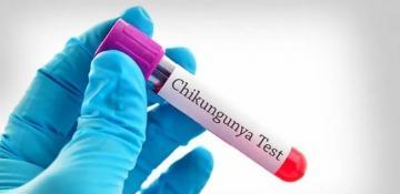 Russia records first case of Chikungunya fever